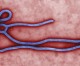 Descartada la presencia de ébola en el paciente sospechoso de Alicante